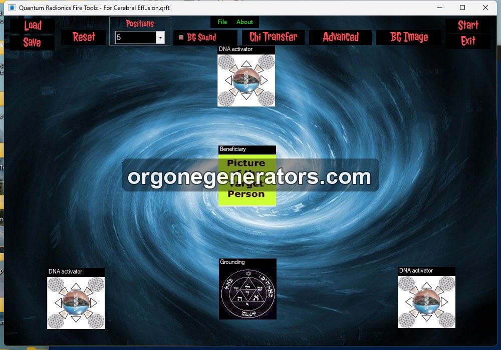 02 cerebral effusion.jpg